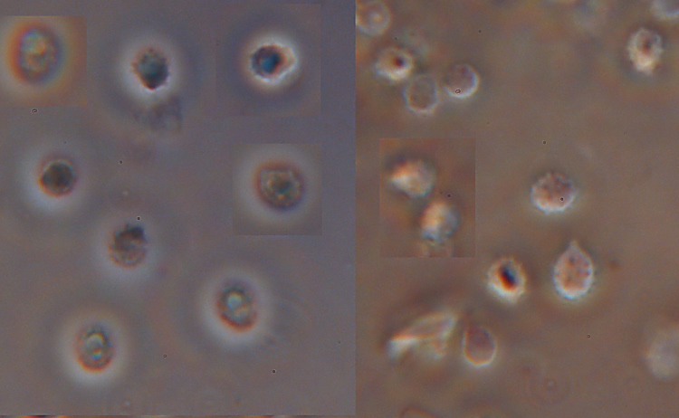 Labile crosticina bianca - foto 3259 (Trechispora farinacea)